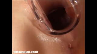 ���ูเลียน Gynecologic สอบและเอาอีตัว Exploration(ที่มีอยู่ใน FullHD)