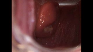 Avy ઓપન Pussy સાથે સ્પેક્યુલુમ